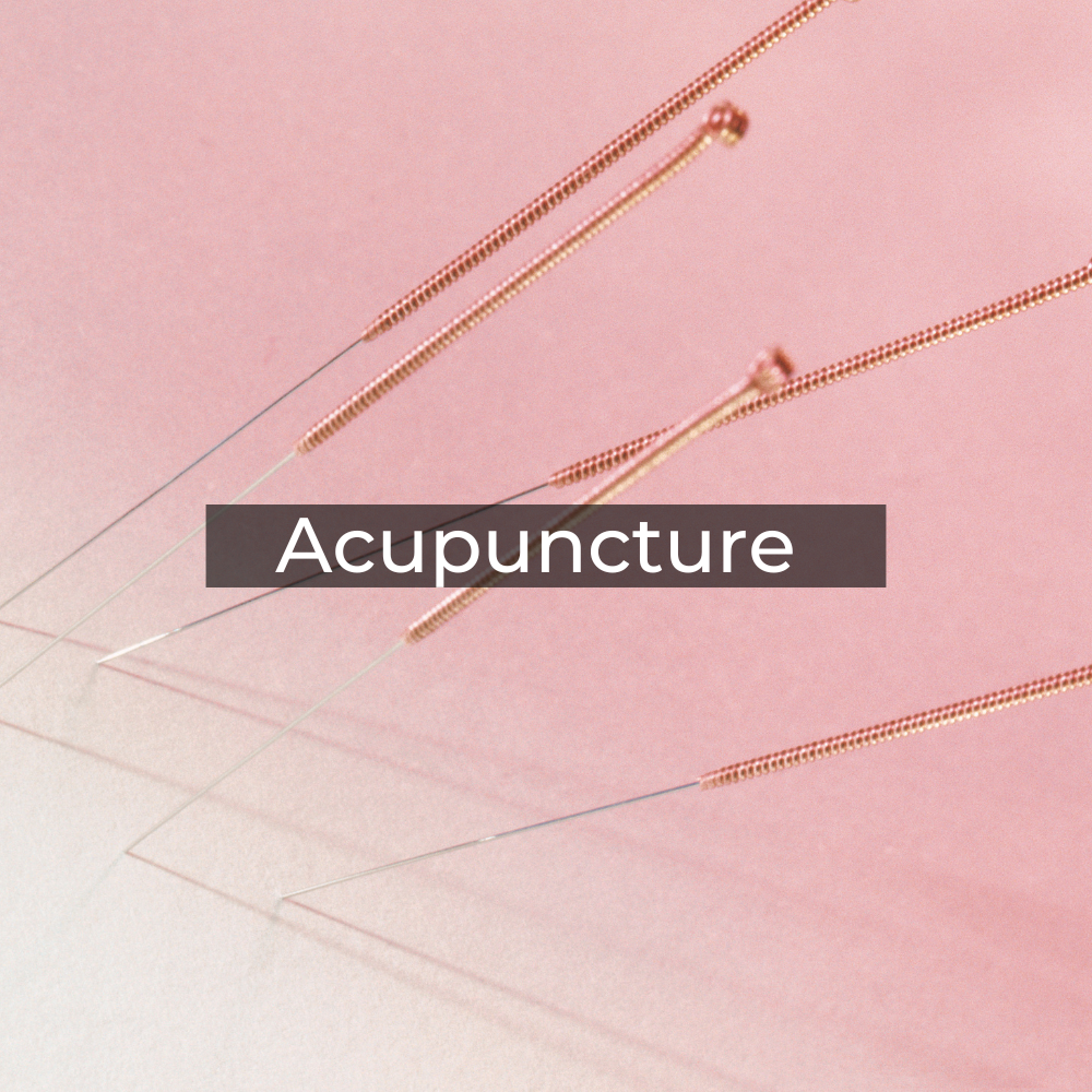 Acupuncture Treatments