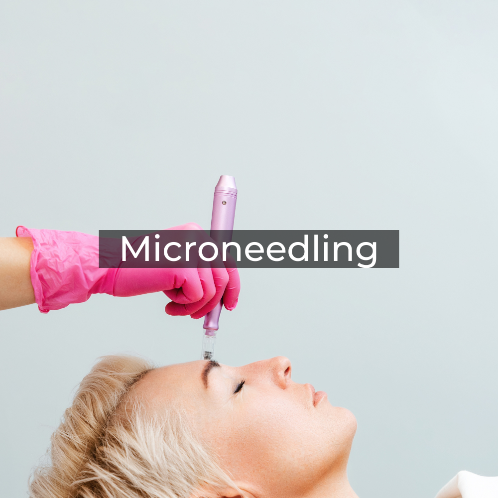Microneedling