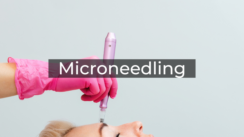 Microneedling